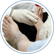 Diabetic Foot Treatment in the Nevada County, CA: Grass Valley (Union Hill, Truckee, Peardale, Willow Valley, La Barr Meadows, Alta Sierra, Nevada City), as well as Placer County, CA: Roseville, Lincoln, Auburn, and Sutter County, CA: Yuba City, Live Oak areas