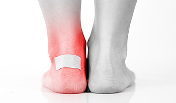 Heel friction deals blister