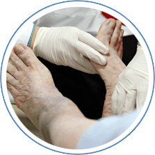 Diabetic Foot Treatment in the Nevada County, CA: Grass Valley (Union Hill, Truckee, Peardale, Willow Valley, La Barr Meadows, Alta Sierra, Nevada City), as well as Placer County, CA: Roseville, Lincoln, Auburn, and Sutter County, CA: Yuba City, Live Oak areas