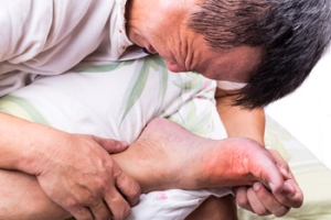 Gout and Diet