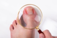 What Might Be Causing Your Toenail Pain