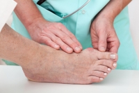 Should I Get Treatment for My Bunions?